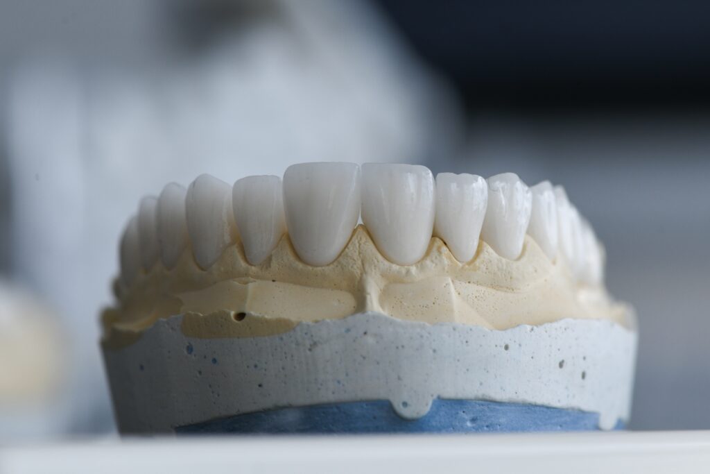 Dental,Zirconium,Crowns,On,A,Lab,Model.